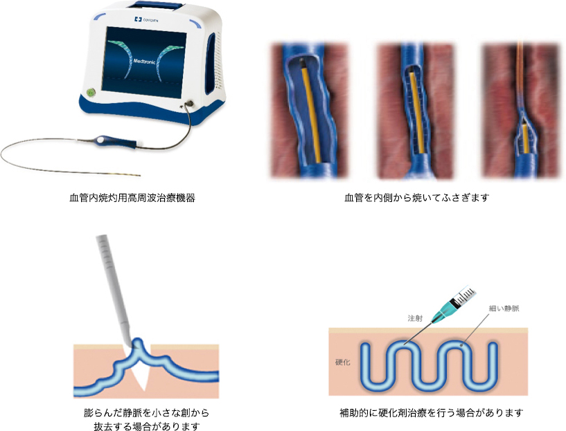 最適な治療方法