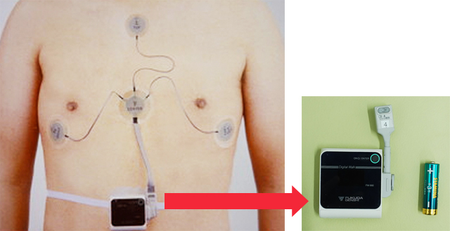 ホルター心電図