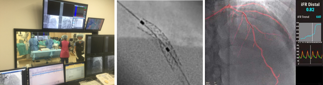 カテーテル検査・治療